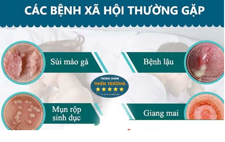 Hình ảnh: Bệnh xã hội.