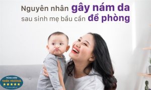 Hình ảnh: Nám da sau sinh.