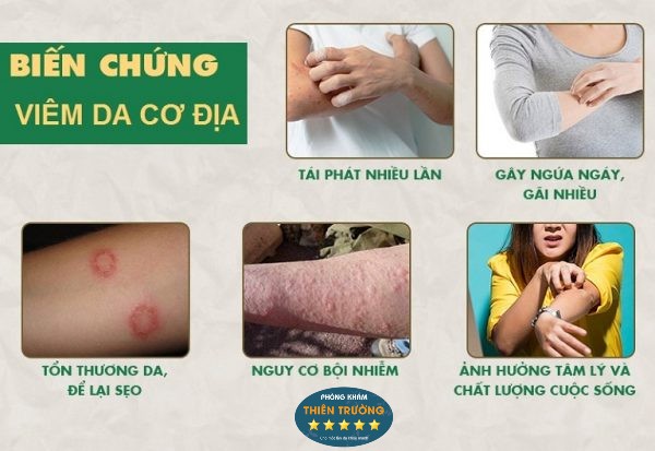 Hình ảnh: Biến chứng của viêm da.