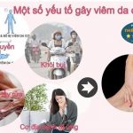 Hình ảnh: Nguyên nhân gây viêm da.