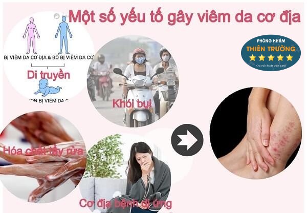 Hình ảnh: Nguyên nhân gây viêm da.