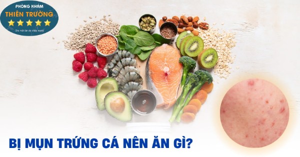 Hình ảnh: Bị mụn trứng cá nên ăn gì?